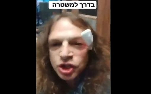 "Город обезьян". В Ашдоде задержан атаковавший профессора Хецрони
